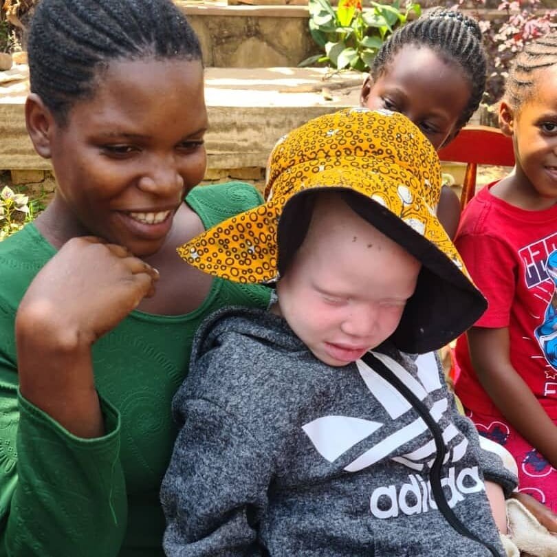 More photos from our International Albinism Awareness Day Event! If you are on #Facebook, go to our page (Mama Mzungu - Natural Soaps from Uganda) to watch our recorded livestream of the event #iaad2021 #iaad #internationalalbinismawarenessday #inter