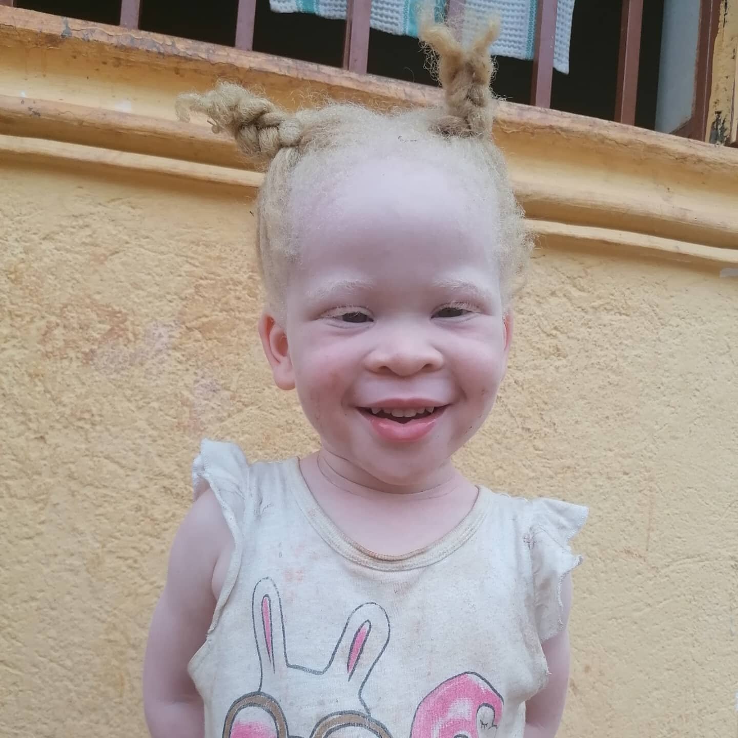 #Repost @monicanorley EMERGENCY Covid Appeal for Women and Children with Albinism in Uganda (WACWAU). I have set up a @gofundme campaign while I am now in Uganda but for some reason my @linktr.ee account isn't working here. So if you go to #Gofundme 