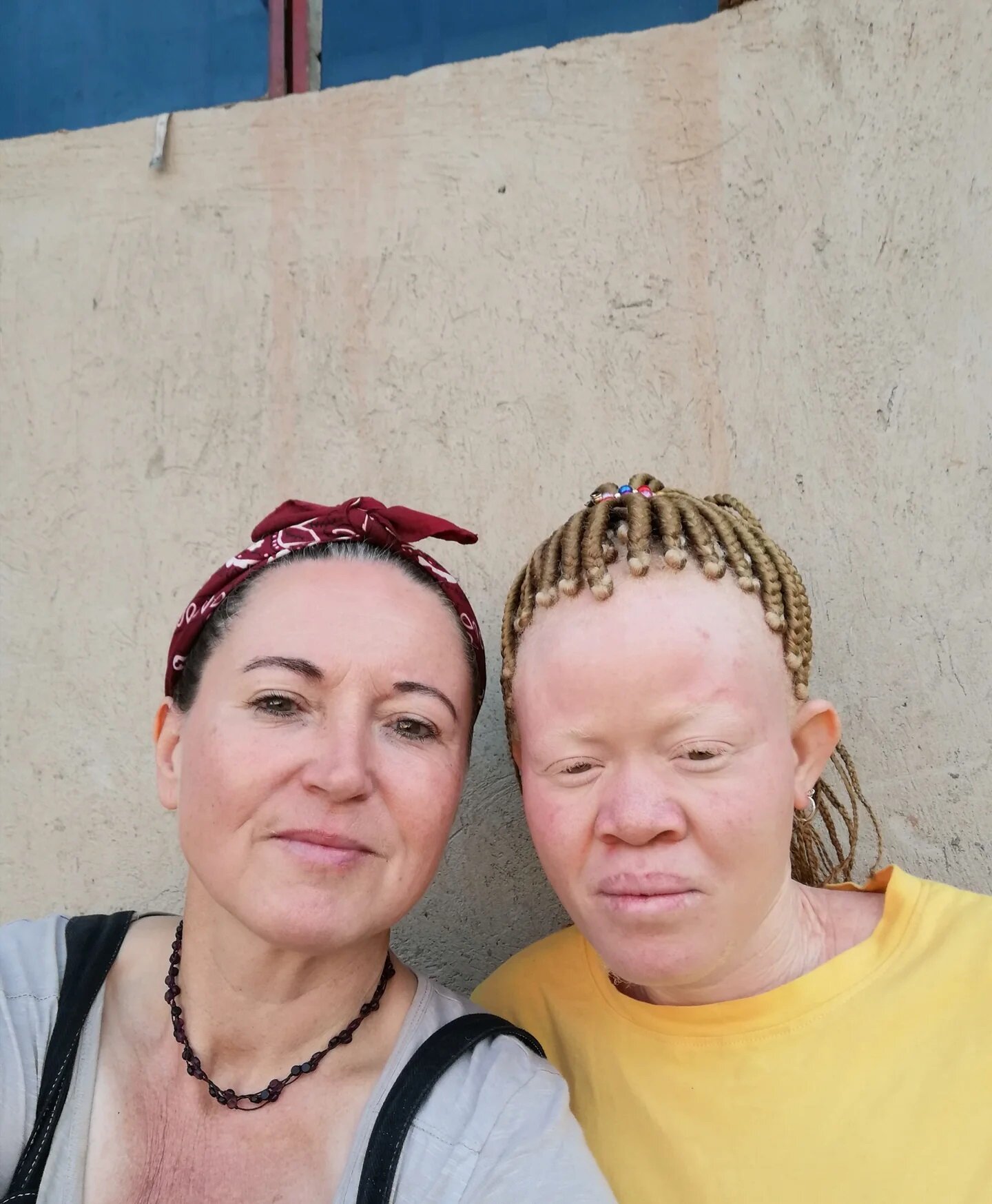 Mama Mzungu is about much more than creating jobs for women affected by Albinism. It's also about creating roles of leadership, helping women create a career path and recognising raw talent and ability. So we're very pleased to be able to announce Te