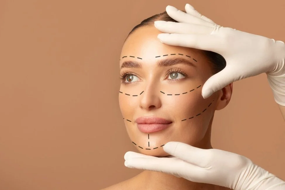 Facelifting Procedure Face Marking