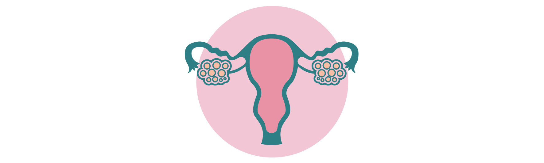 Polycystic Ovarian Syndrome Sydney Endocrinology Multidisciplinary Management Of Diabetes Thyroid Pcos