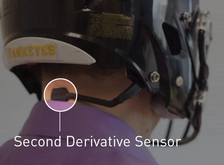 second-derivative-sensor.jpg