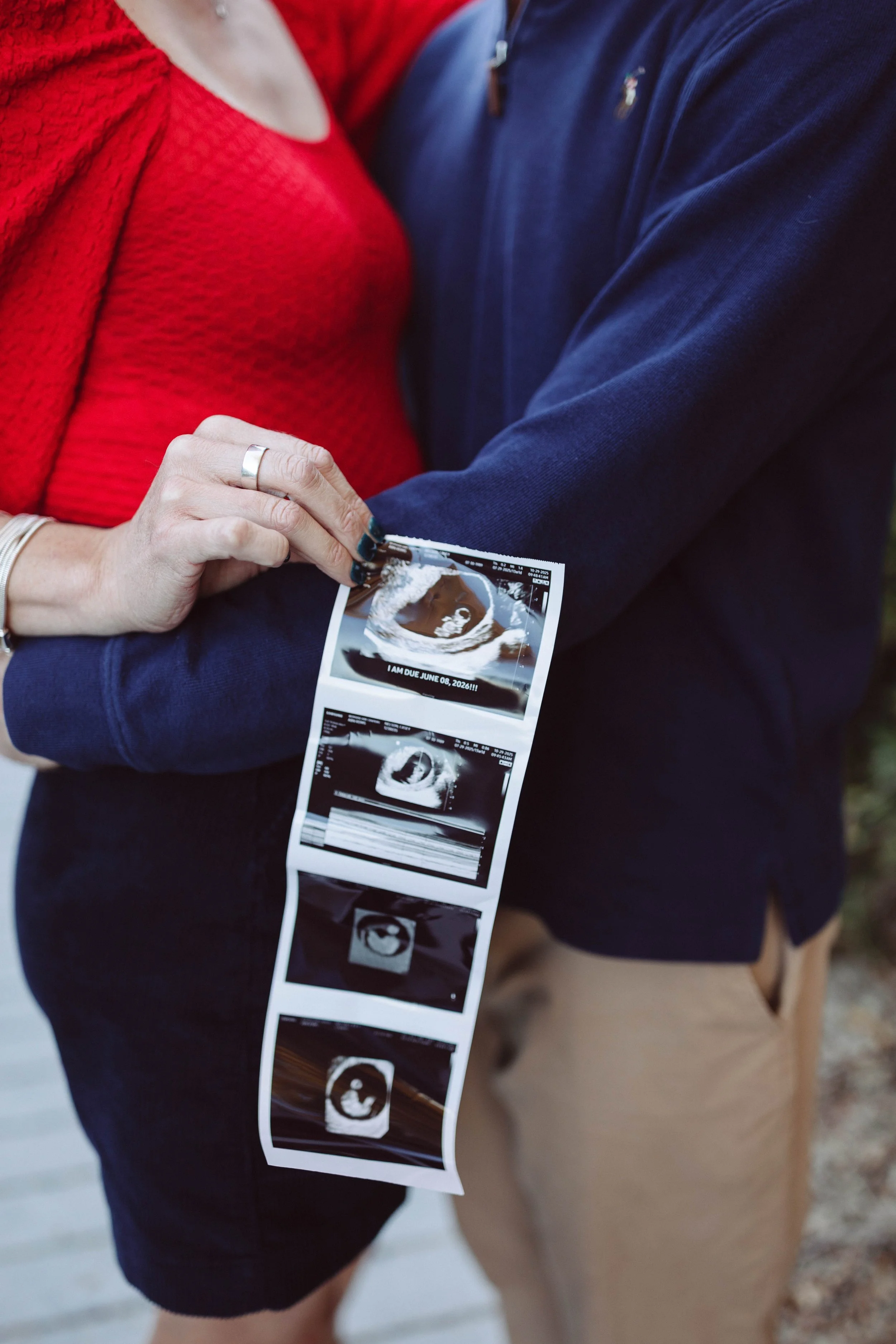 Virginia Beach couple holds ultrasound images