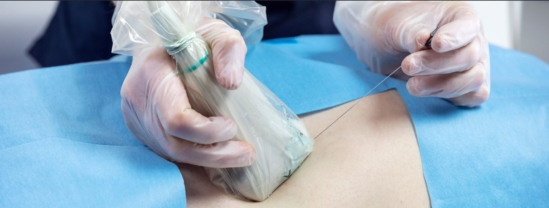 Emergency Department POCUS a New Frontier