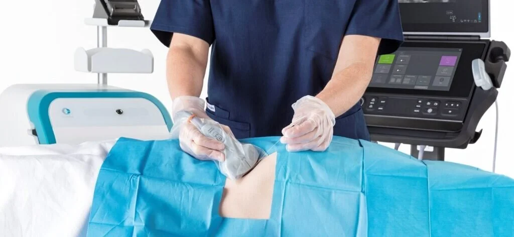 Sonosite Ultrasound Probes Compatible with Chronos