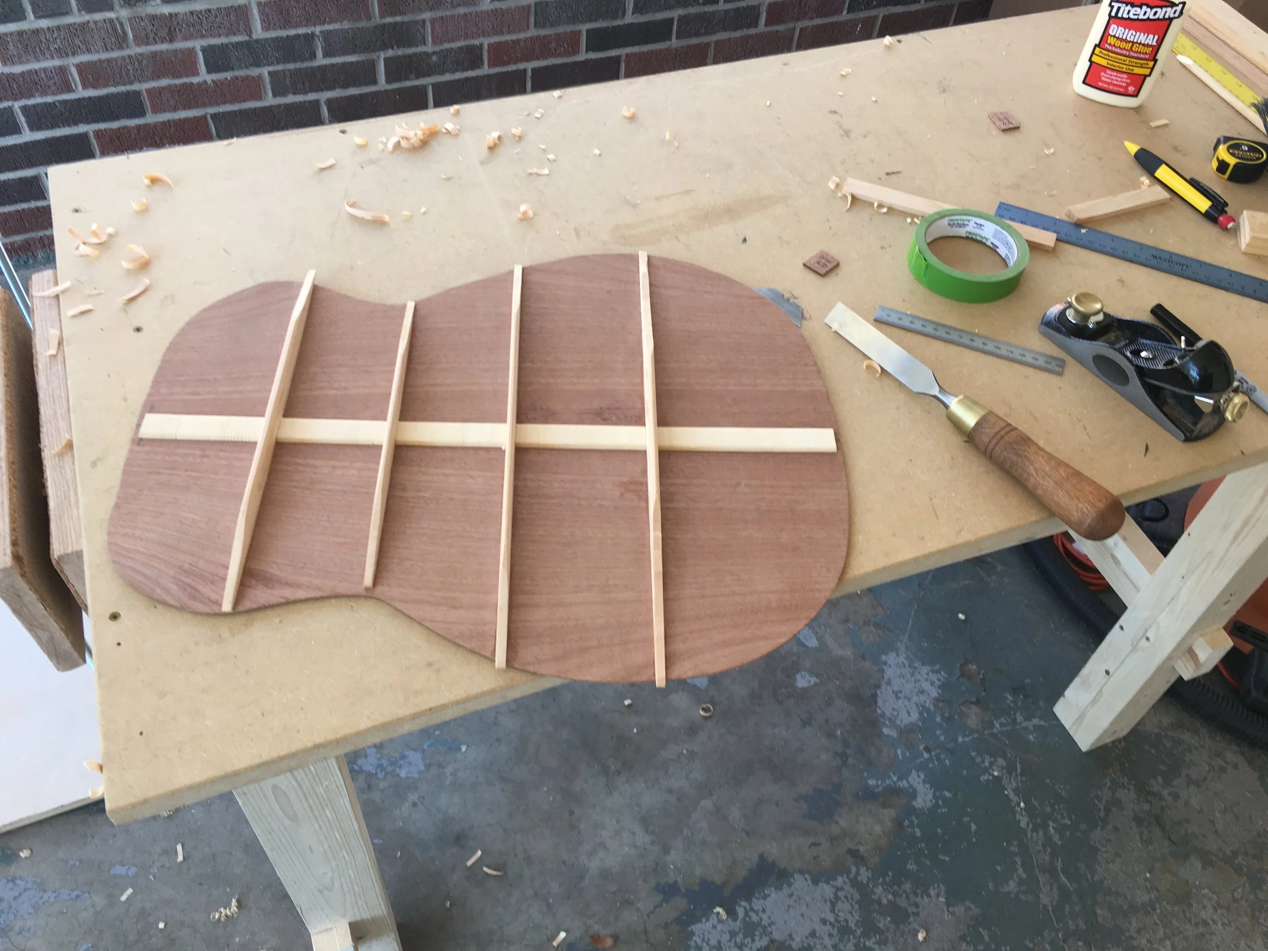 #1-Back Braces and The Radius