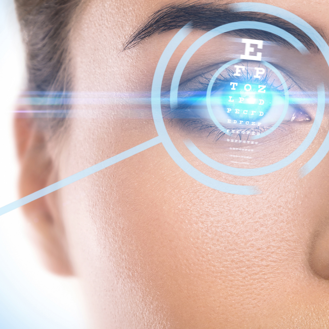 LASIK VISION CONNECTION
