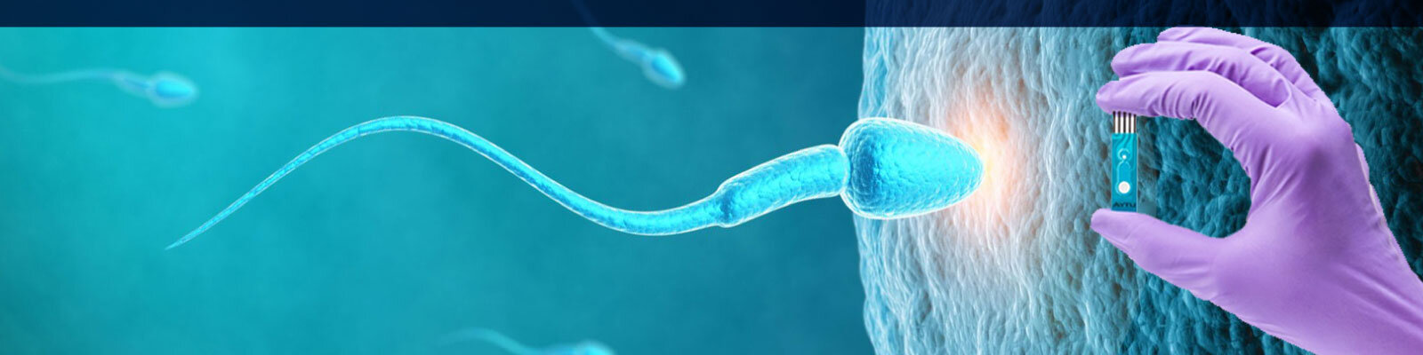 MiOXSYS - Male Infertility Oxidative System — LogixX Fertility