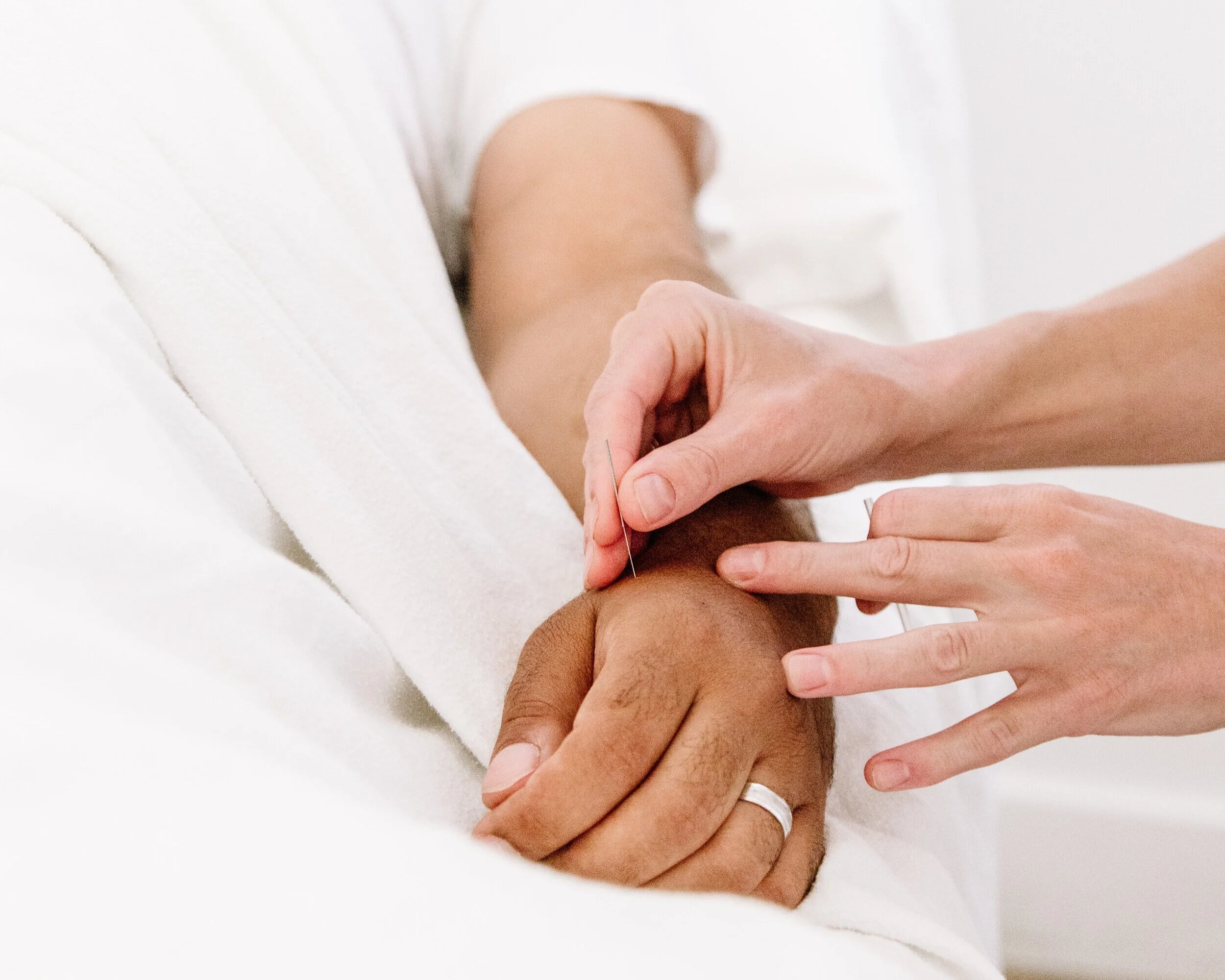 Acupuncture + Male Fertility How Can It Help? — wellbe family wellness