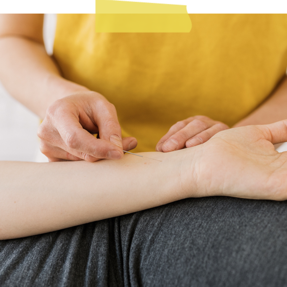 acupuncture for pre and postnatal — wellbe family wellness