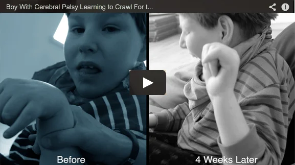 New Somatic Rehabilitation Techniques for Children with Special Needs