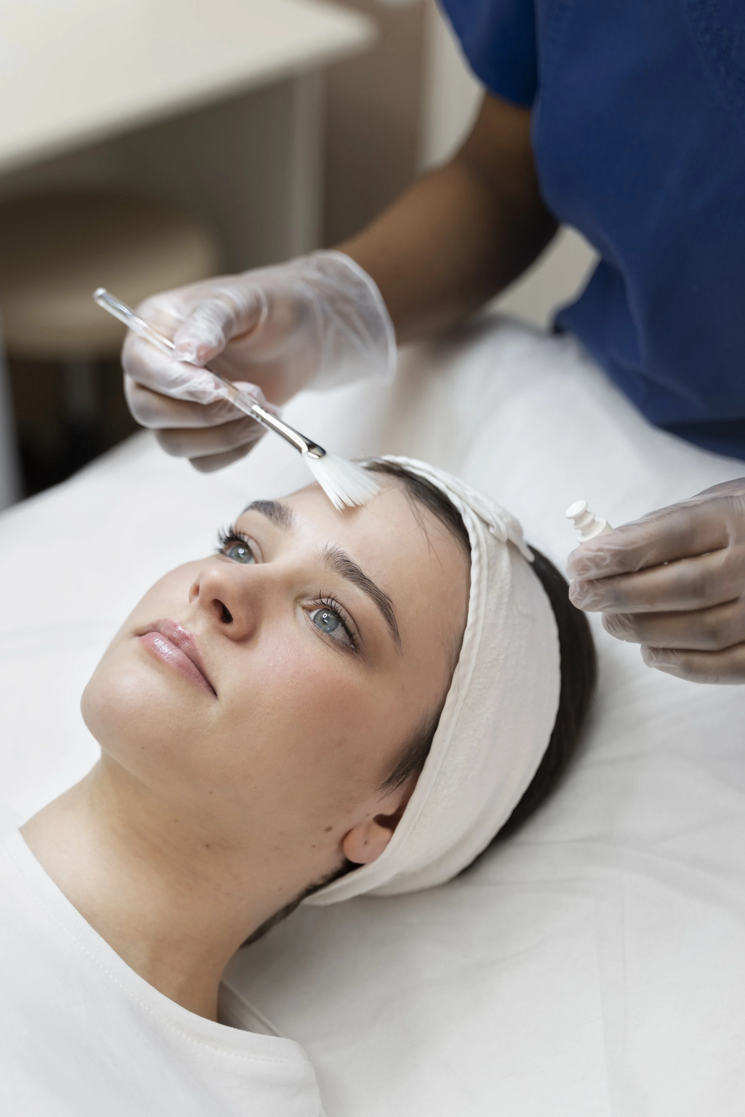 chemical peel