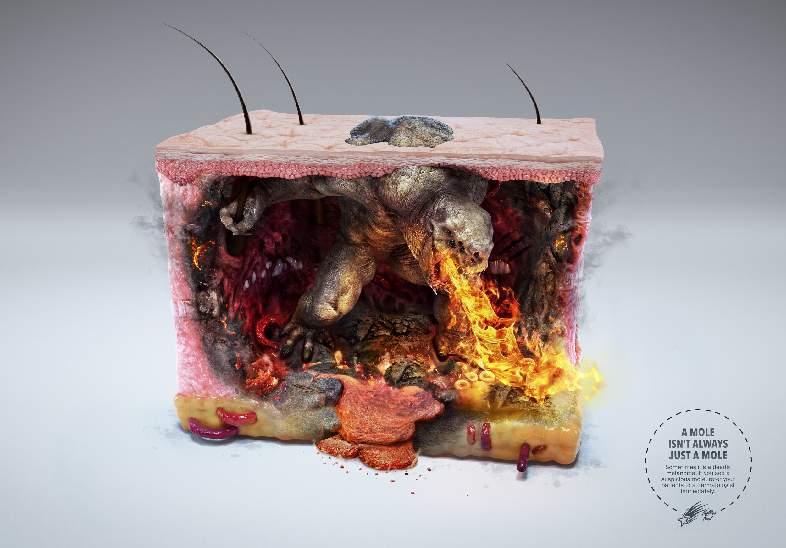 Melanoma+Monster+-+Volcano.jpg
