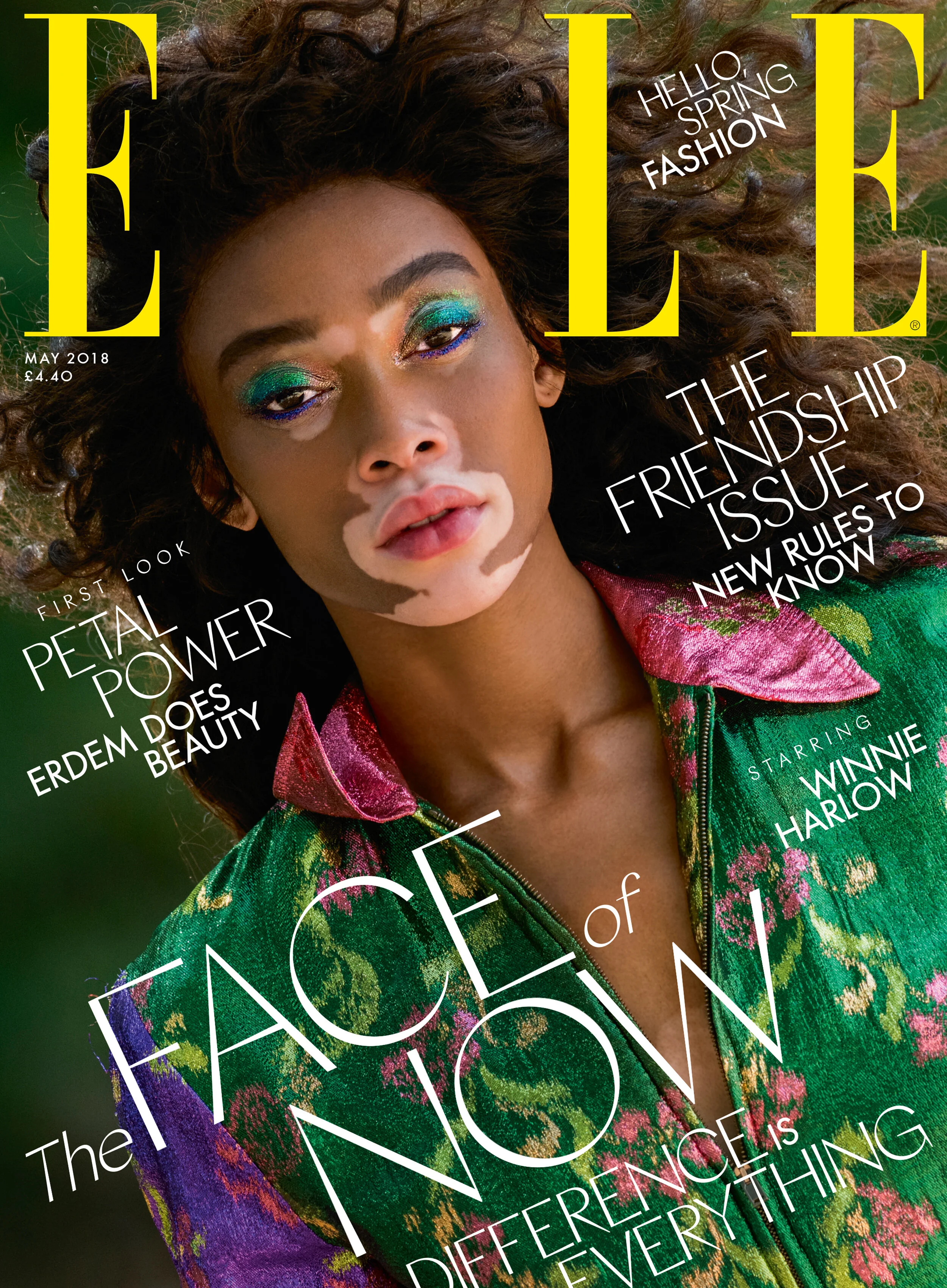 Winnie Harlow/Gilles Bensimon