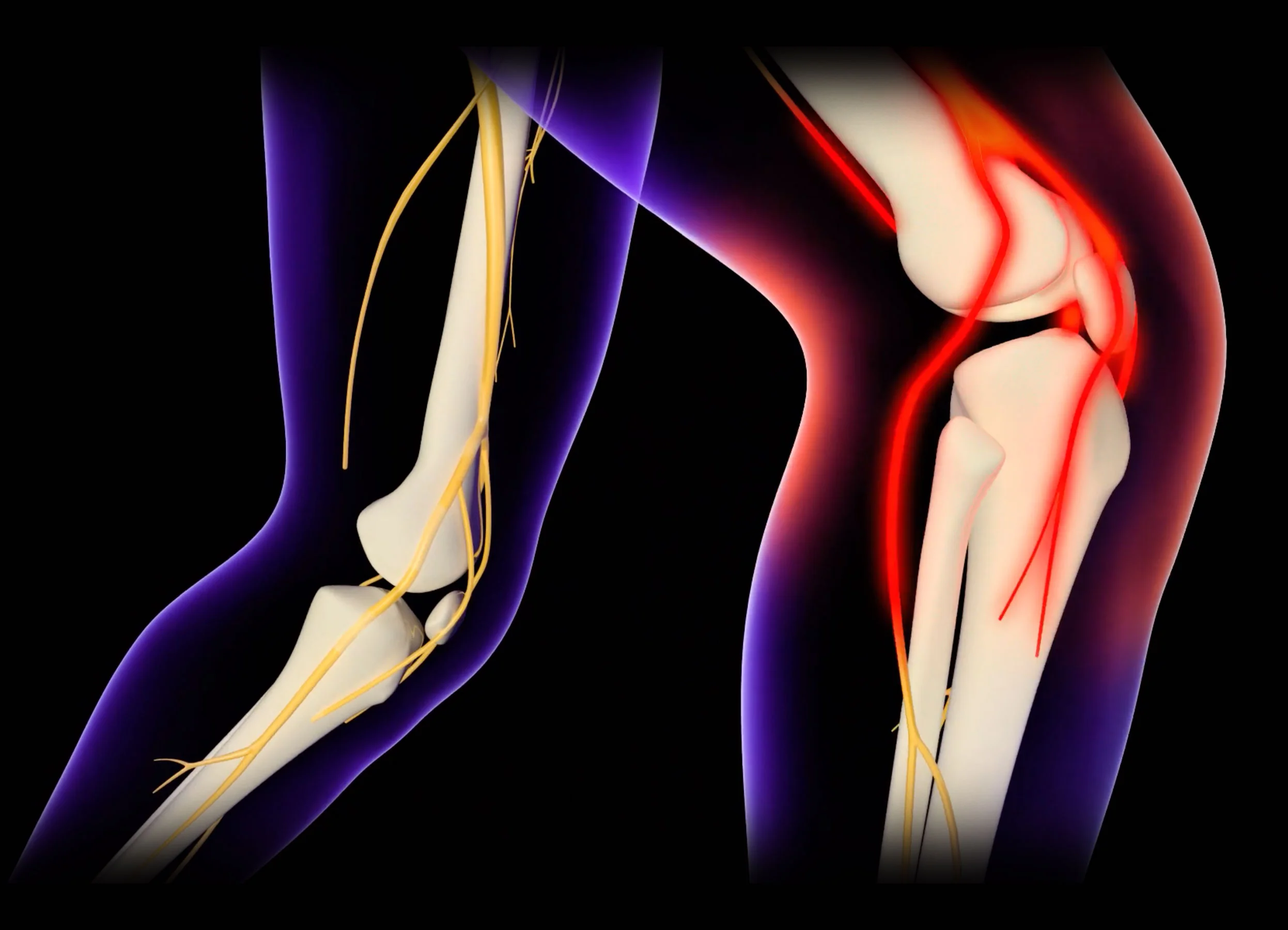 legbase.jpg
