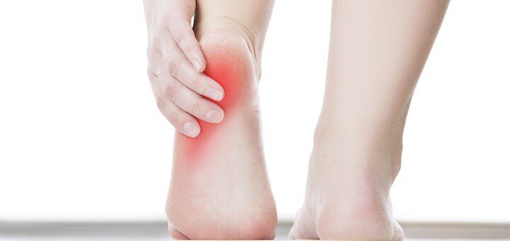 I Think I Have Plantar Fasciitis...