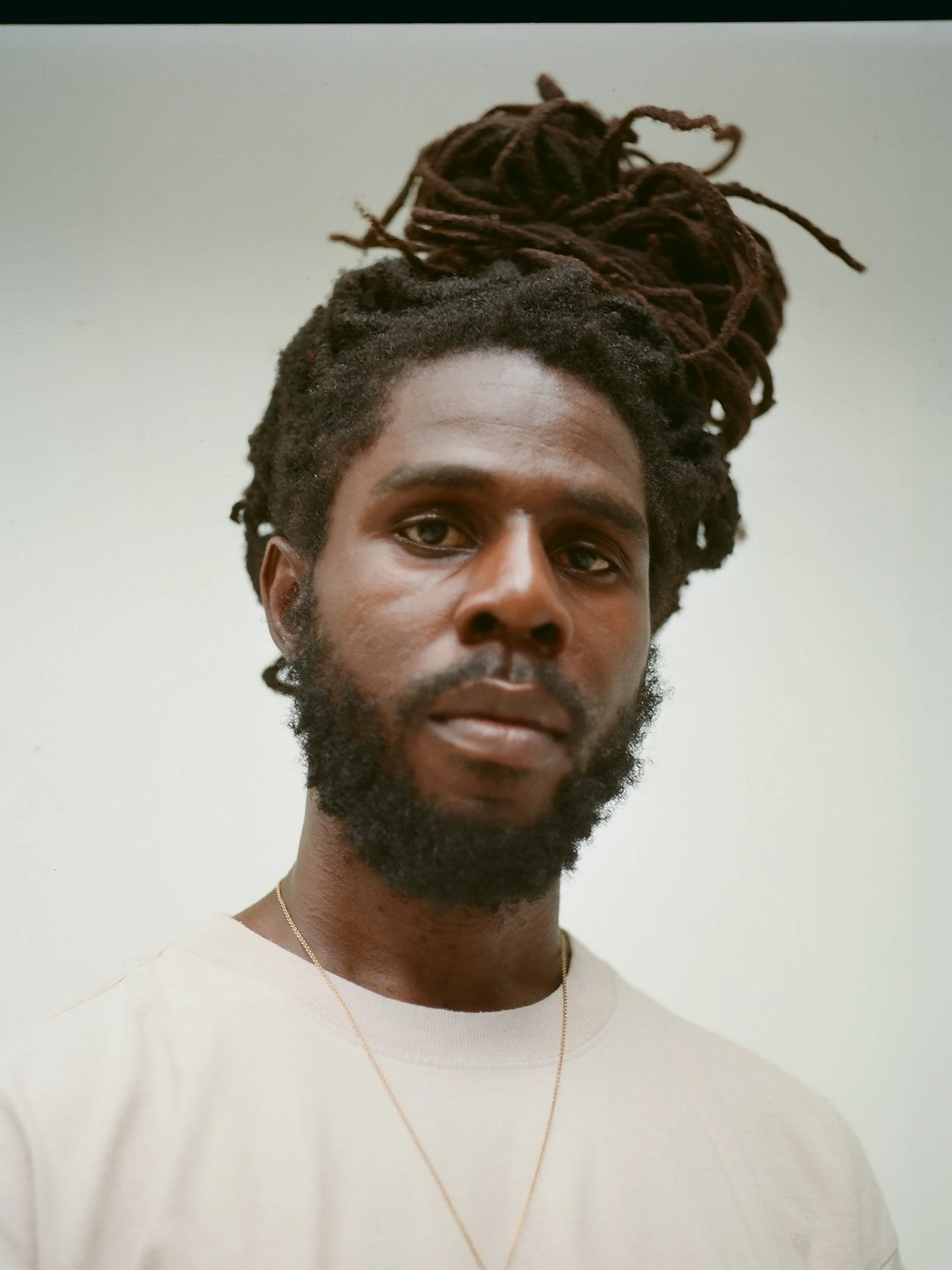 EP 72 // CHRONIXX