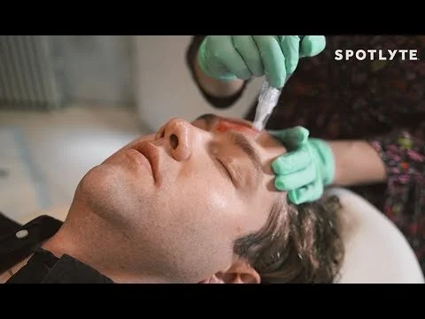 Improve Skin Tone & Fine Lines with the Vampire Facial | TreatMEnt of the Week