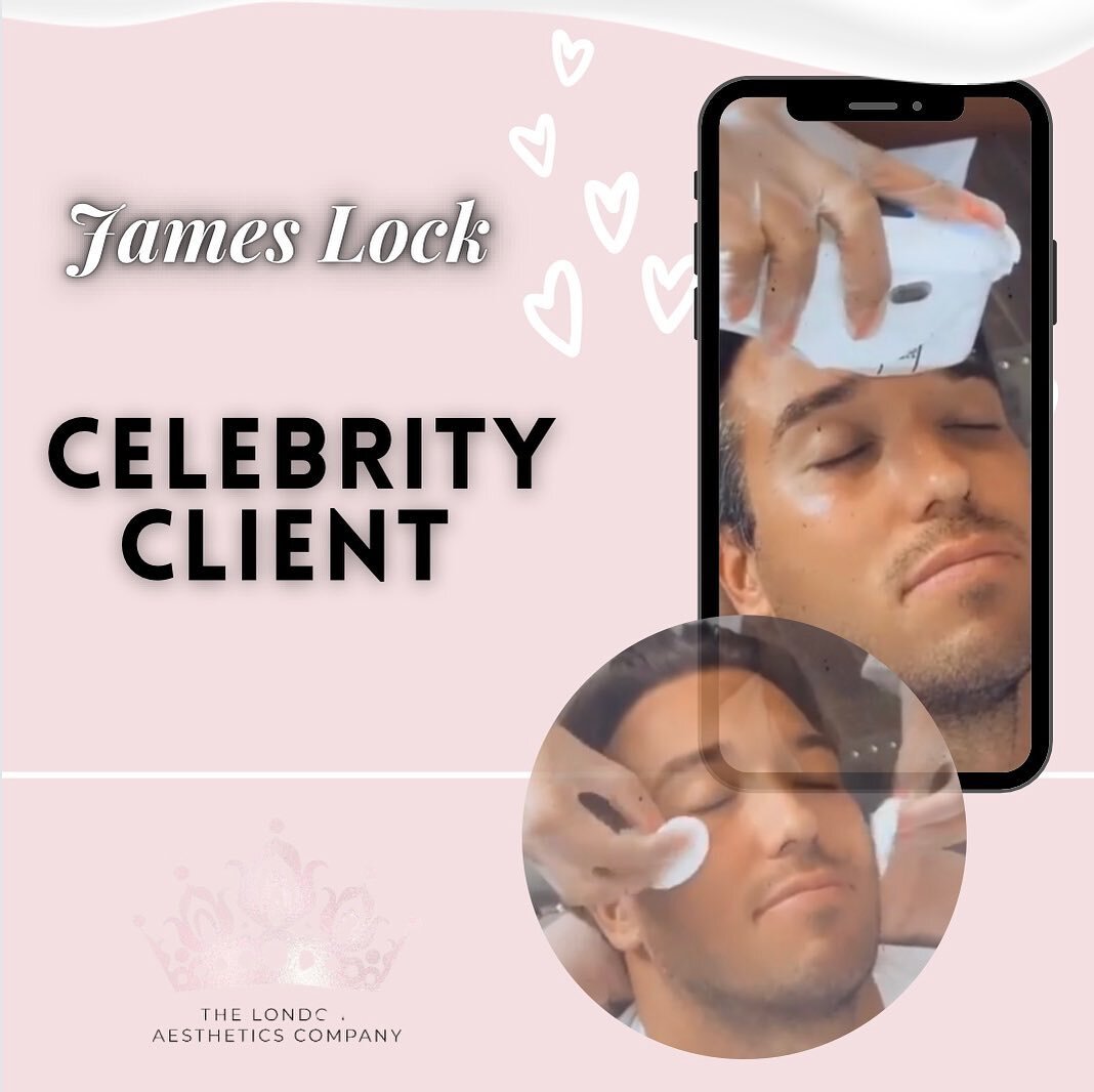 𝐂𝐄𝐋𝐄𝐁𝐑𝐈𝐓𝐘 𝐂𝐋𝐈𝐄𝐍𝐓𝐒 📸 

@towie James Lock came to us previously for bespoke skin treatments 
to anti age, tighten and plump the skin, and give that natural hydrated glow 💭

📲 BOOK dermal fillers at The London Aesthetics 
💻 Link in b