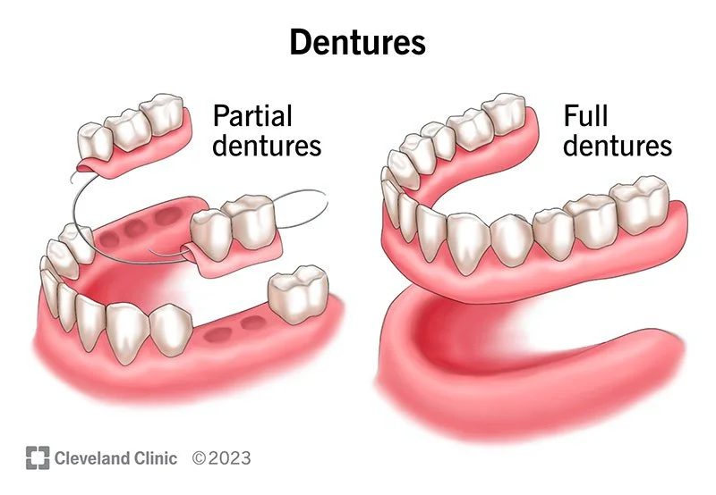 10900-dentures.jpg