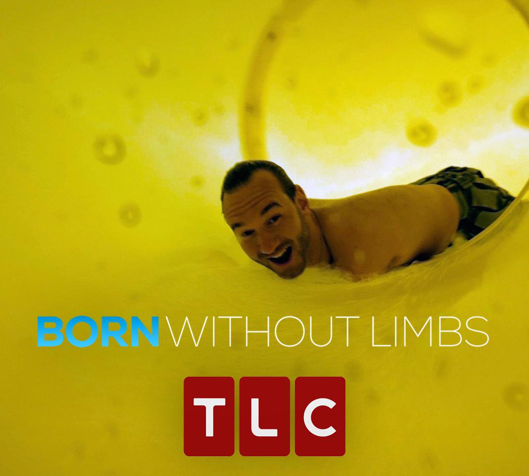 born without limbs.jpg