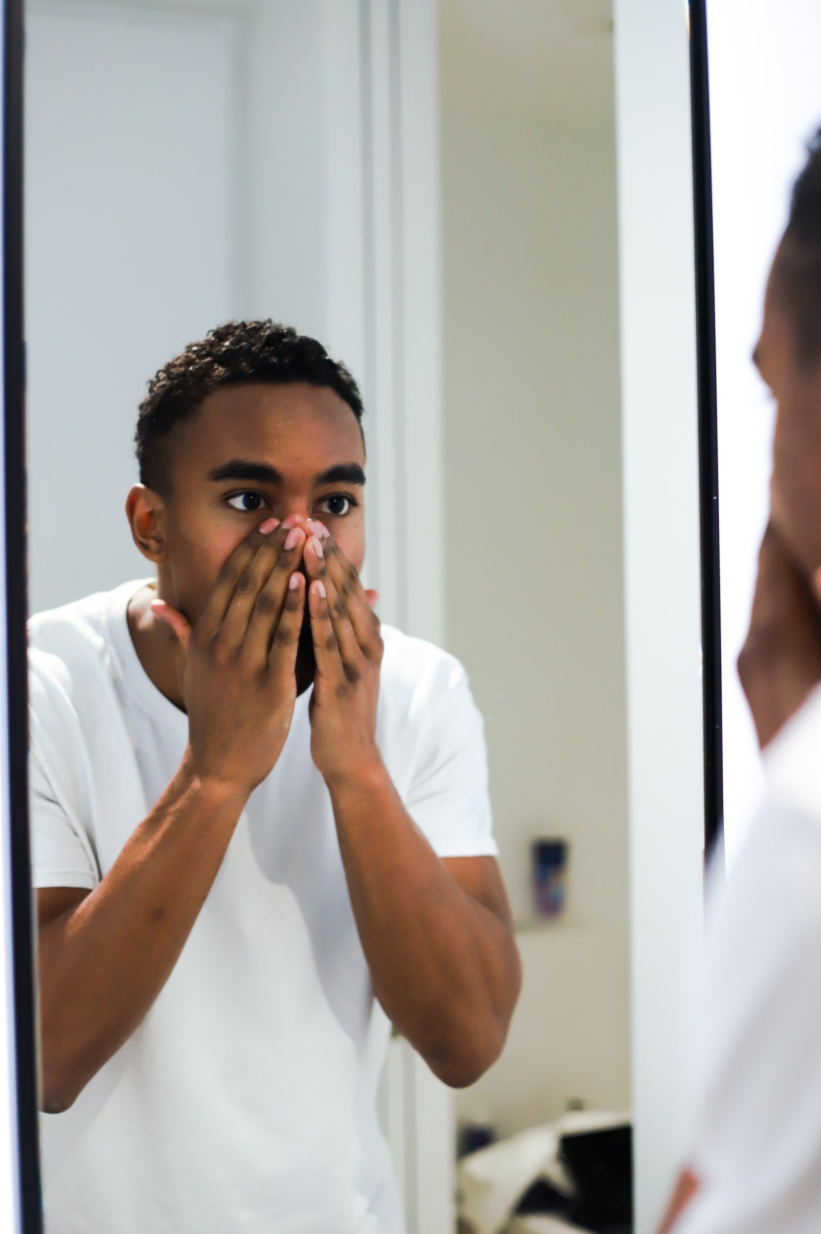Clearing Acne Holistically