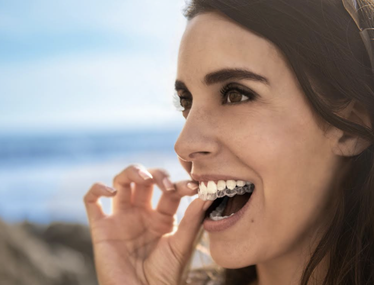 What Are the Benefits of invisible braces?