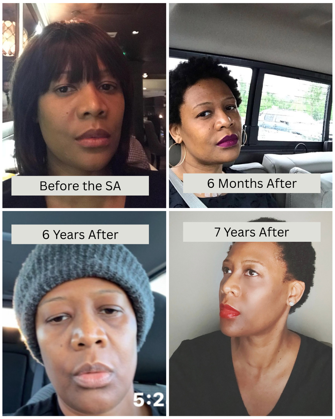 TL Robinson, GOTU Founder & CEO, shares how trauma from the sexual assault impacted her physical appearance over the last 7 years.