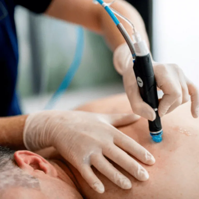 A medical professional wearing gloves performs a procedure on a person's back using a specialized device in a clinical setting.