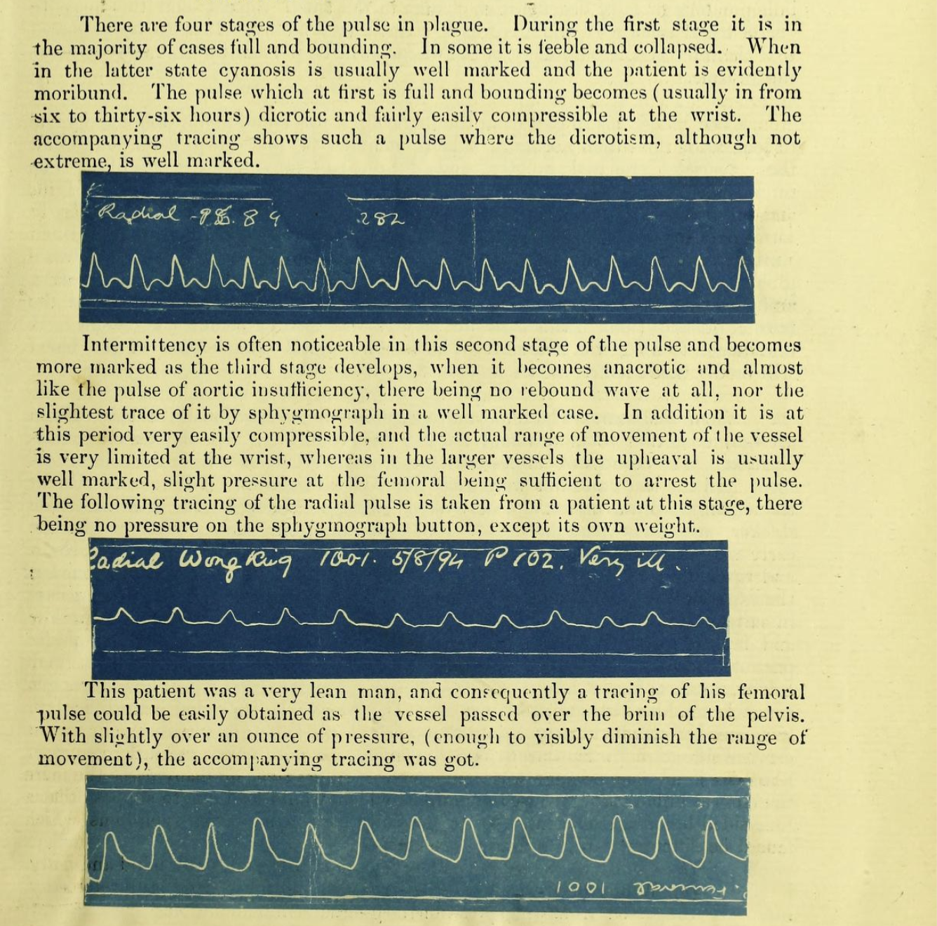 Patient Vitals of the Bubonic Plague in China
