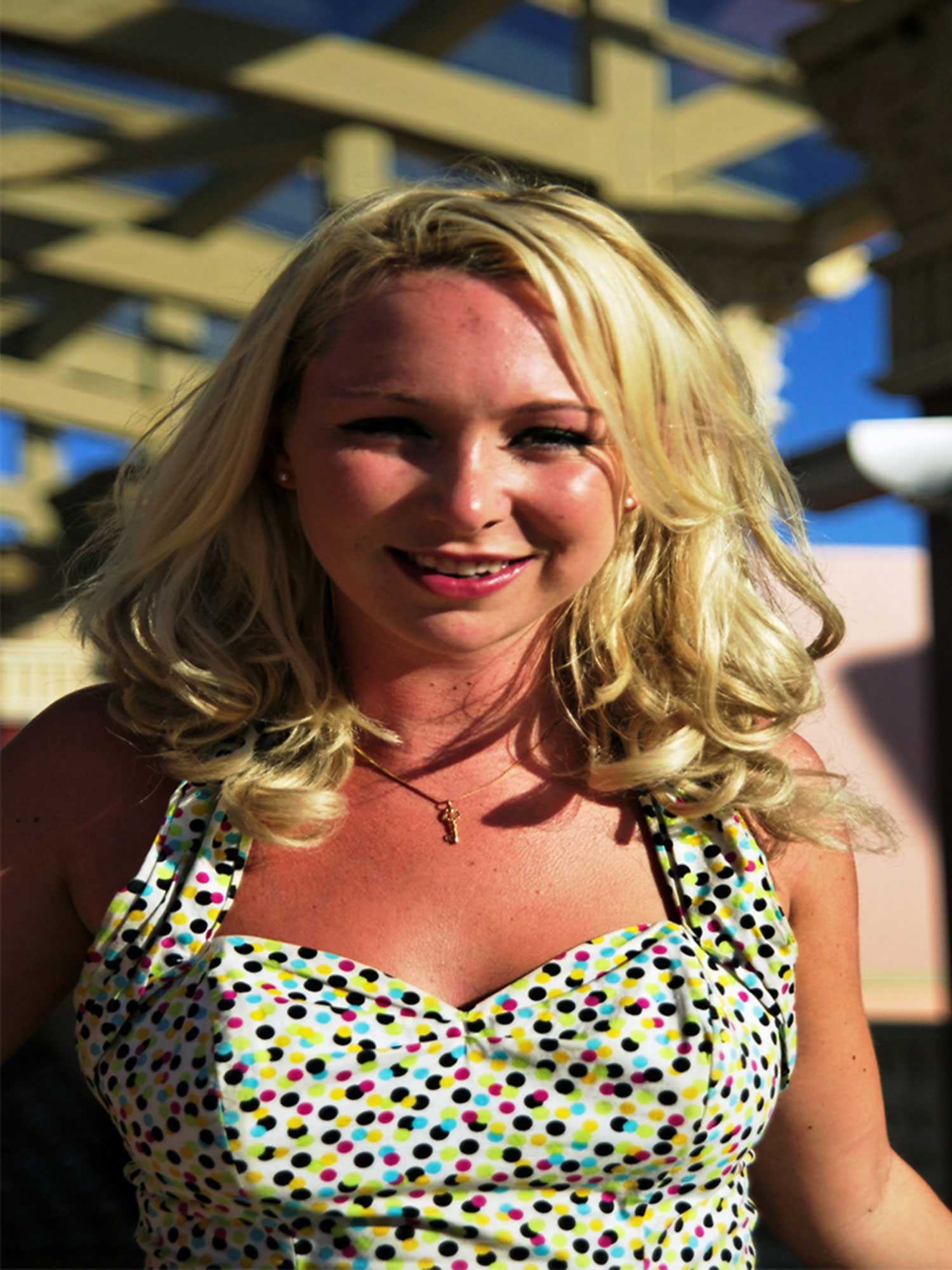 Remove-sunburn-and-improve-image-with-photoshop-service---Before.jpg