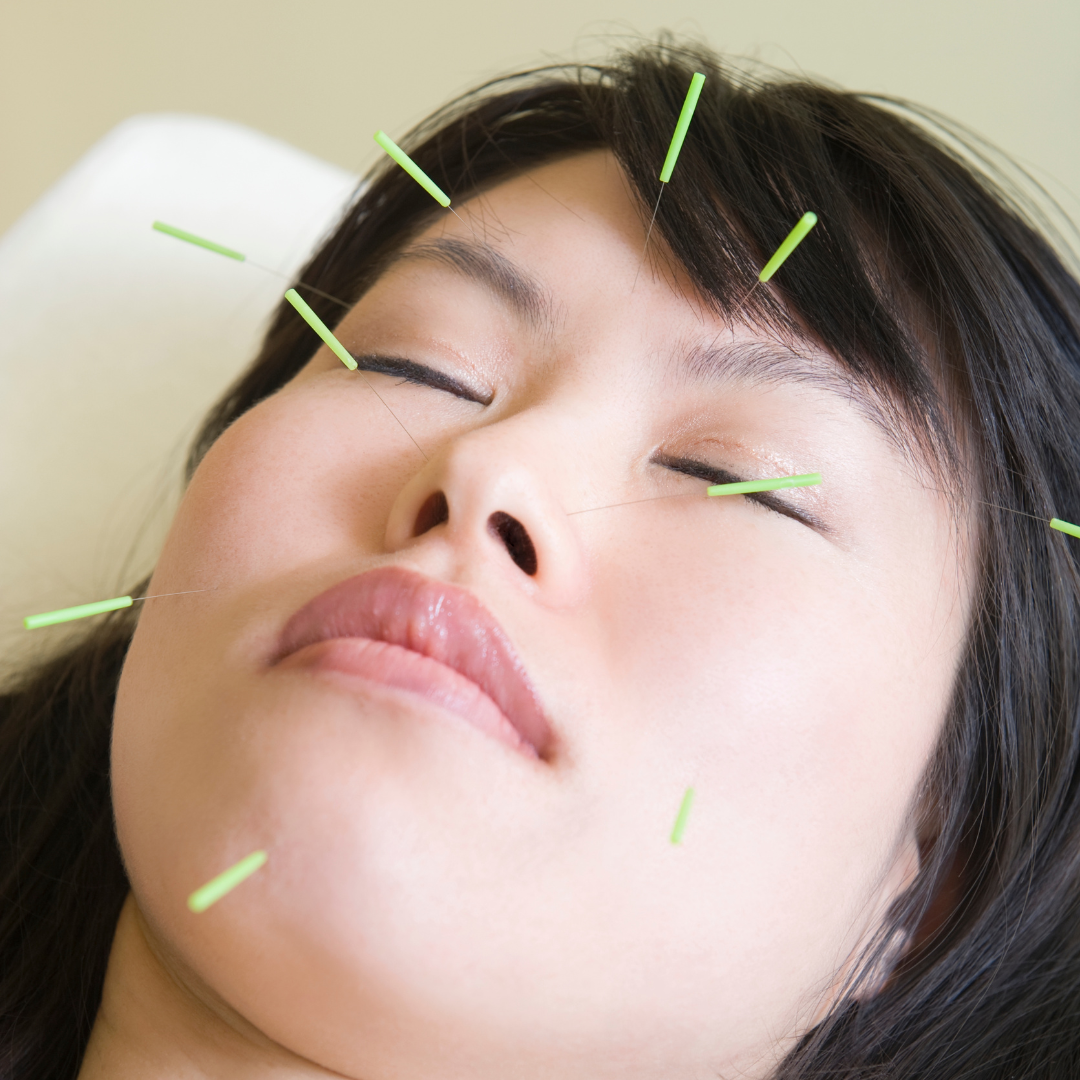 Embrace your Unique Beauty with Cosmetic Acupuncture