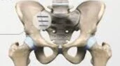 Safety and Reproducibility of Sacroiliac Joint Fusion  in an Ambulatory Surgery Center