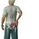 Workers Compensation Patients Return to Work After SI Joint Fusion