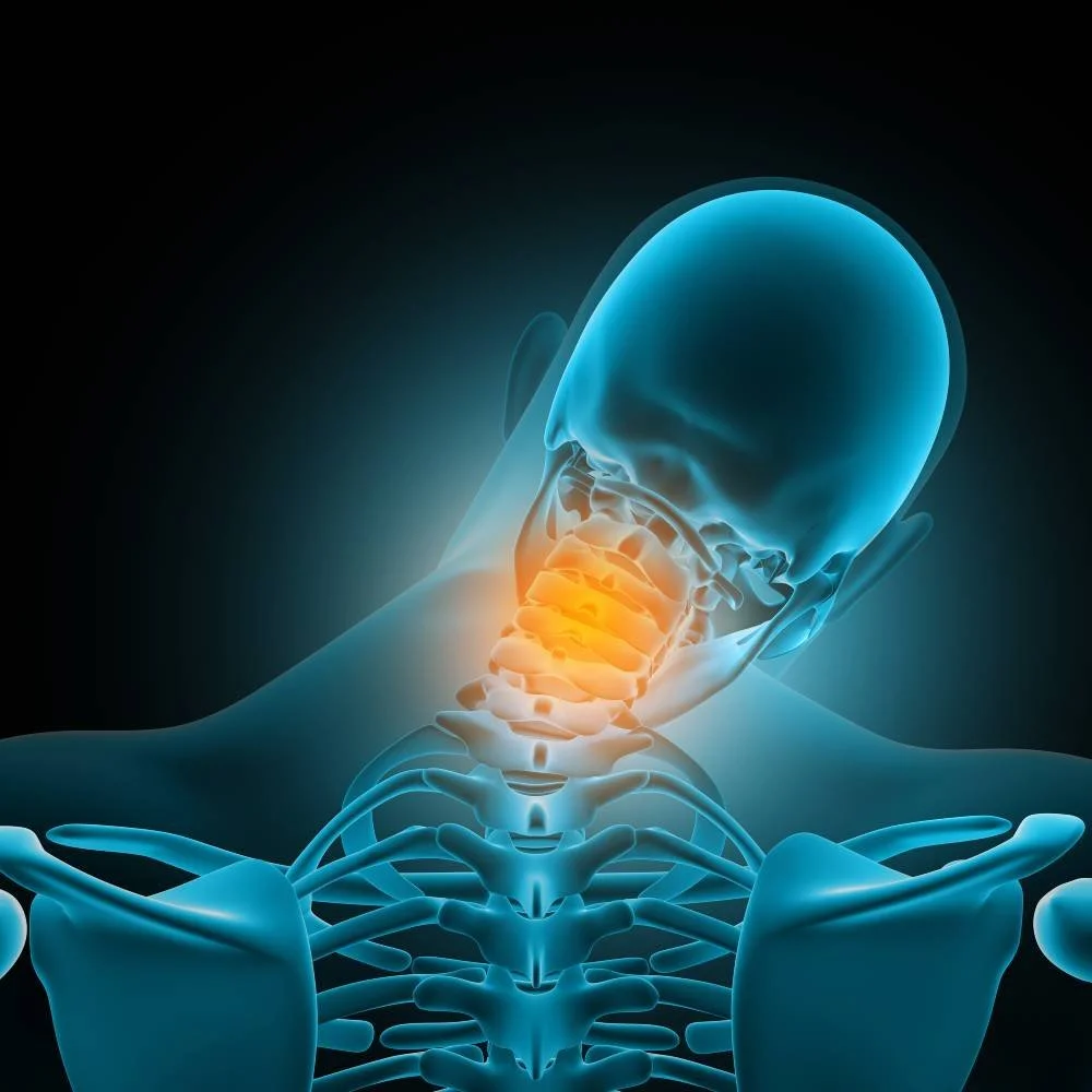 Posterior Cervical Fusion: A Comprehensive Guide to Neck Stabilization Surgery