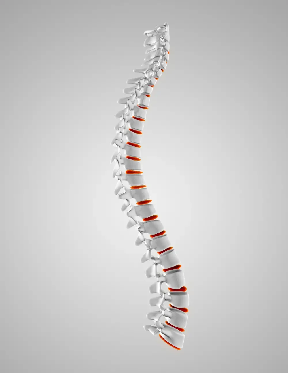 When Do You Need Spine Surgery? Signs, Diagnosis, and Treatment Options