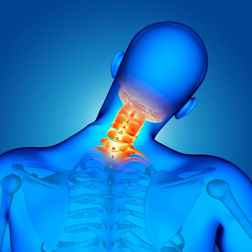 Cervical Disc Replacement with Mobi-C: A Modern Solution for Neck Pain Relief