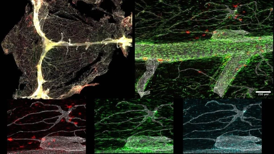 Two days left for the 2025 GSR Symposium!!
GSRS 2025 Biomedical Image of the Year Winner: Connor Dufort (CNUP)
Pro-repair macrophages fill the dural meninges of the mouse brain post-stroke
#sciencenerds #imaging #biomedicalresearch #bgsa #studento