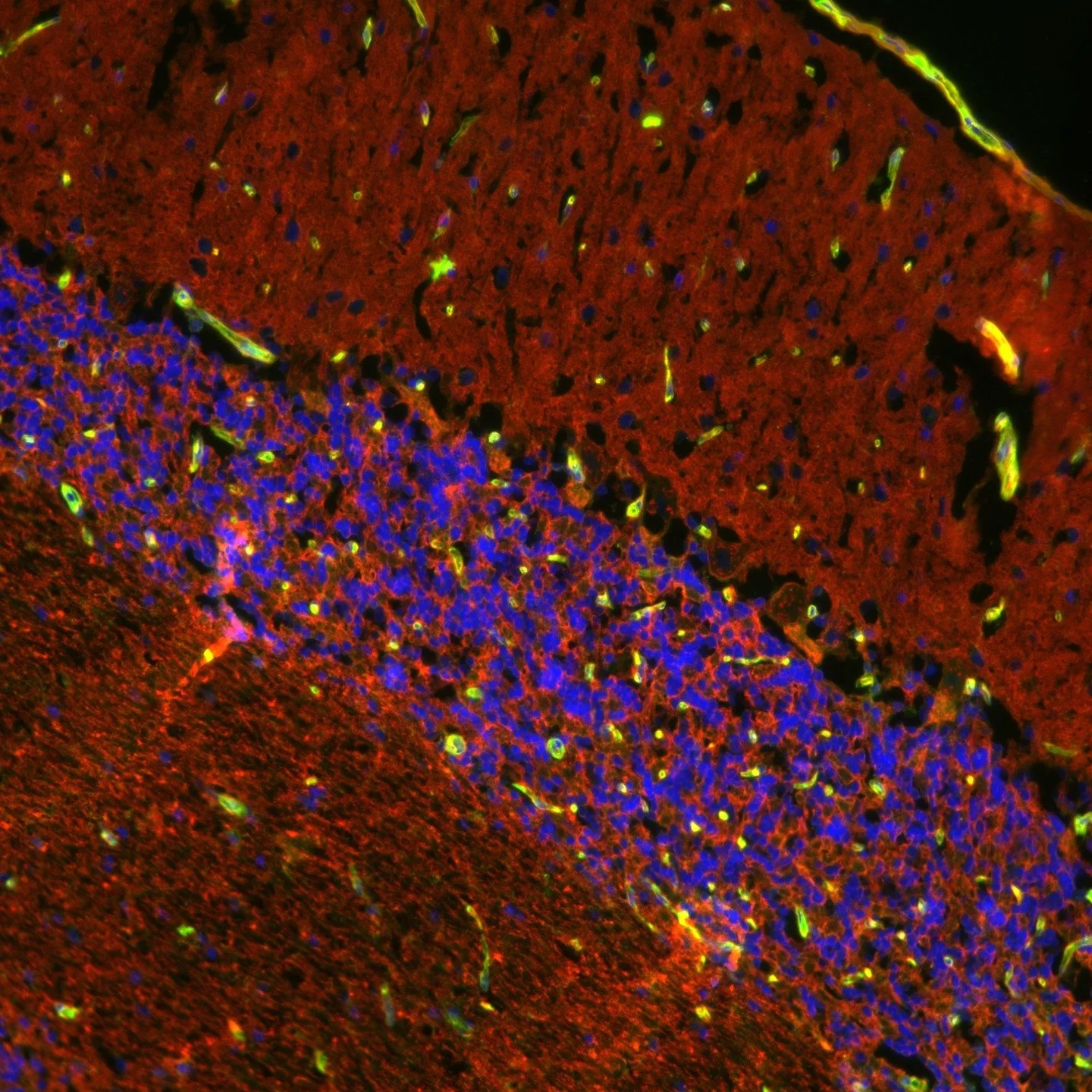 Two days left for the 2025 GSR Symposium!!
GSRS 2025 Biomedical Image of the Year 3rd Place: Daria Jelic (PMI)
Ferret Cerebellum Sialic Acid Histochemistry
#sciencenerds #imaging #biomedicalresearch #bgsa #studentorg
