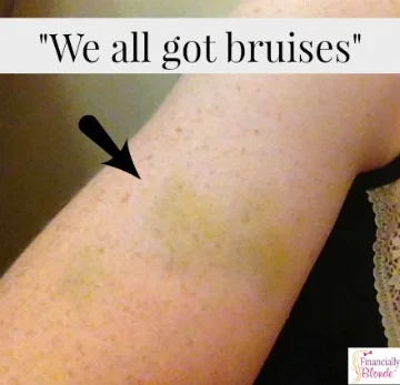 Music Mondays - Bruises