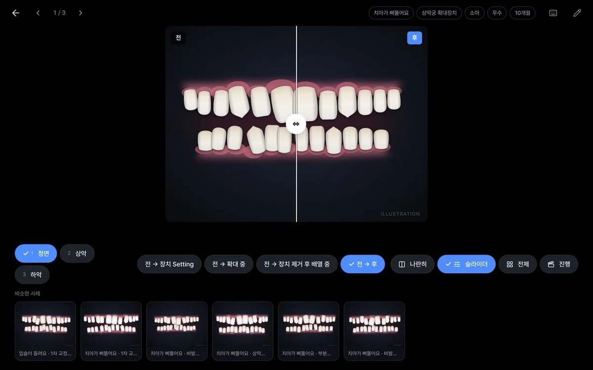 The oosm chair-side view: one illustrated case, before and after, on a slider