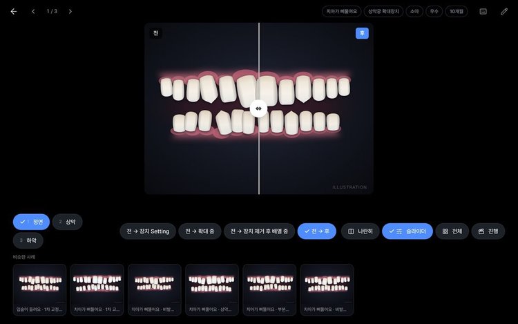 Slider view