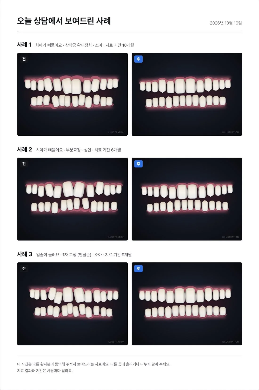 The take-home sheet: cases shown in today’s consult, each a before and after front view