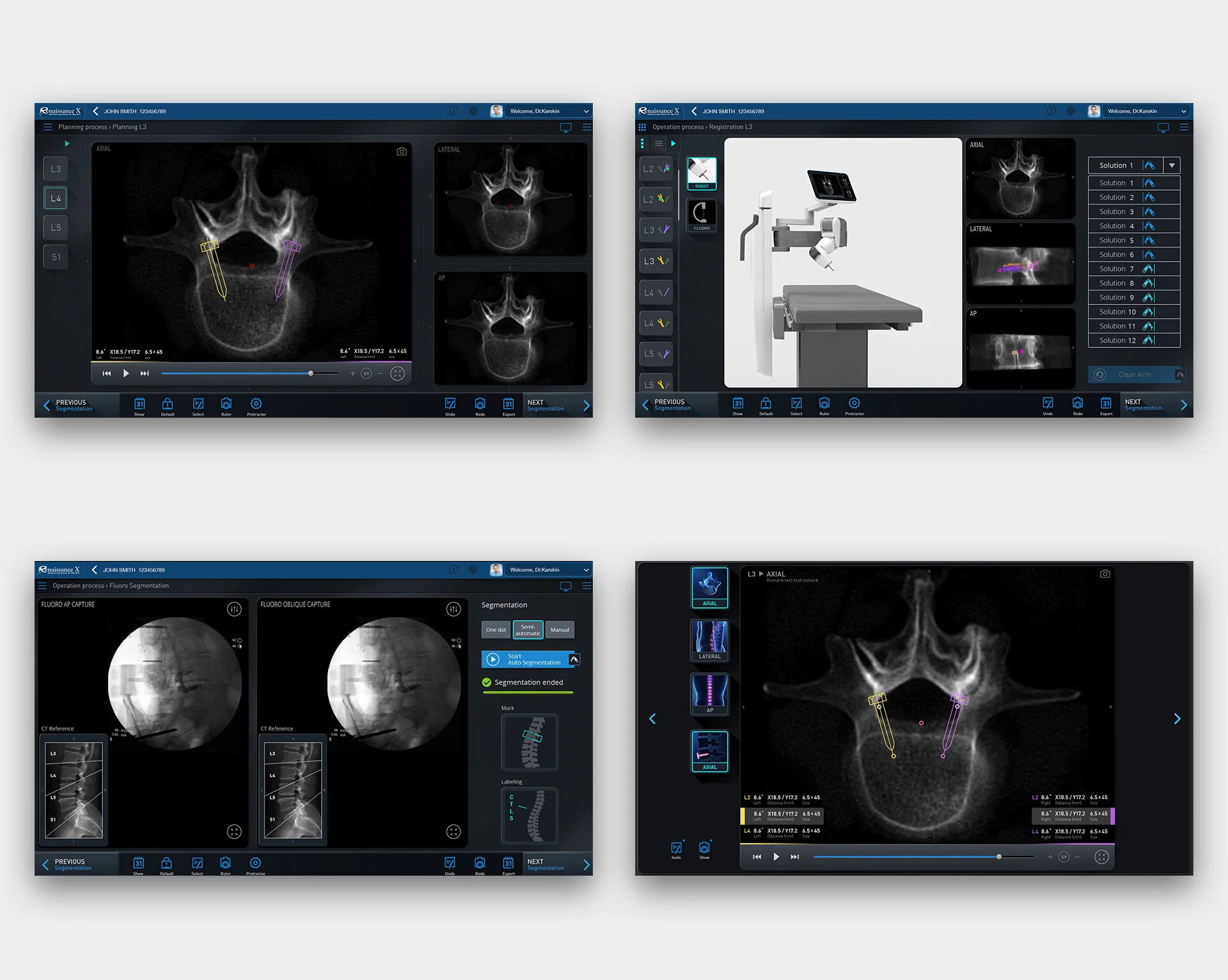 My main focus was on usability, precise UI components, and taking into consideration environmental, physical variables such as the lightning in the surgery room. 