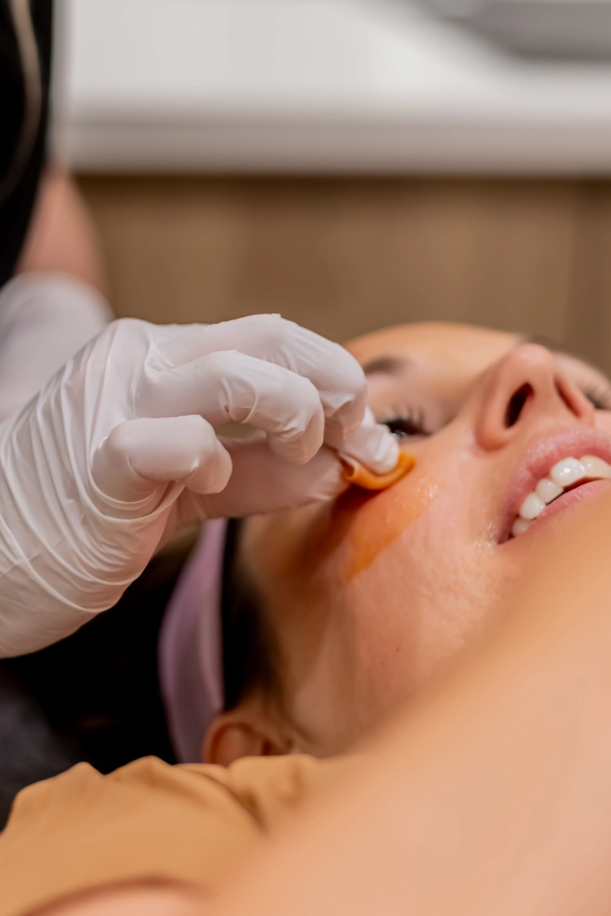 The Perfect Fall Service: Chemical Peels