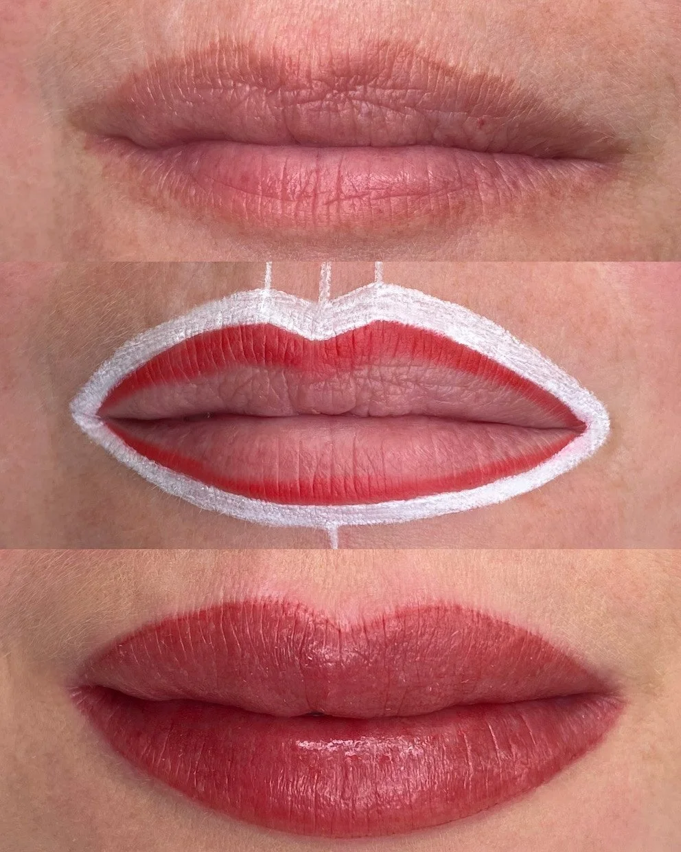 Before-During-Right After Treatment