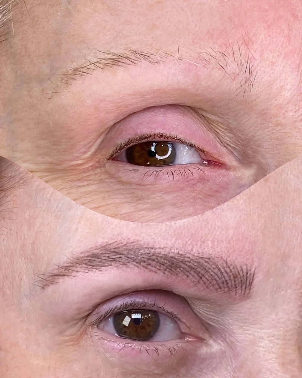 Before & After First Treatment
