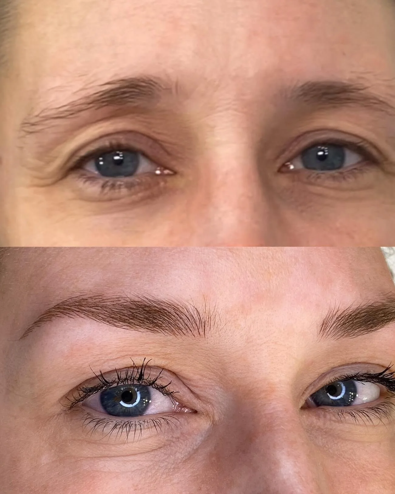 Getting Back a Youthful Look