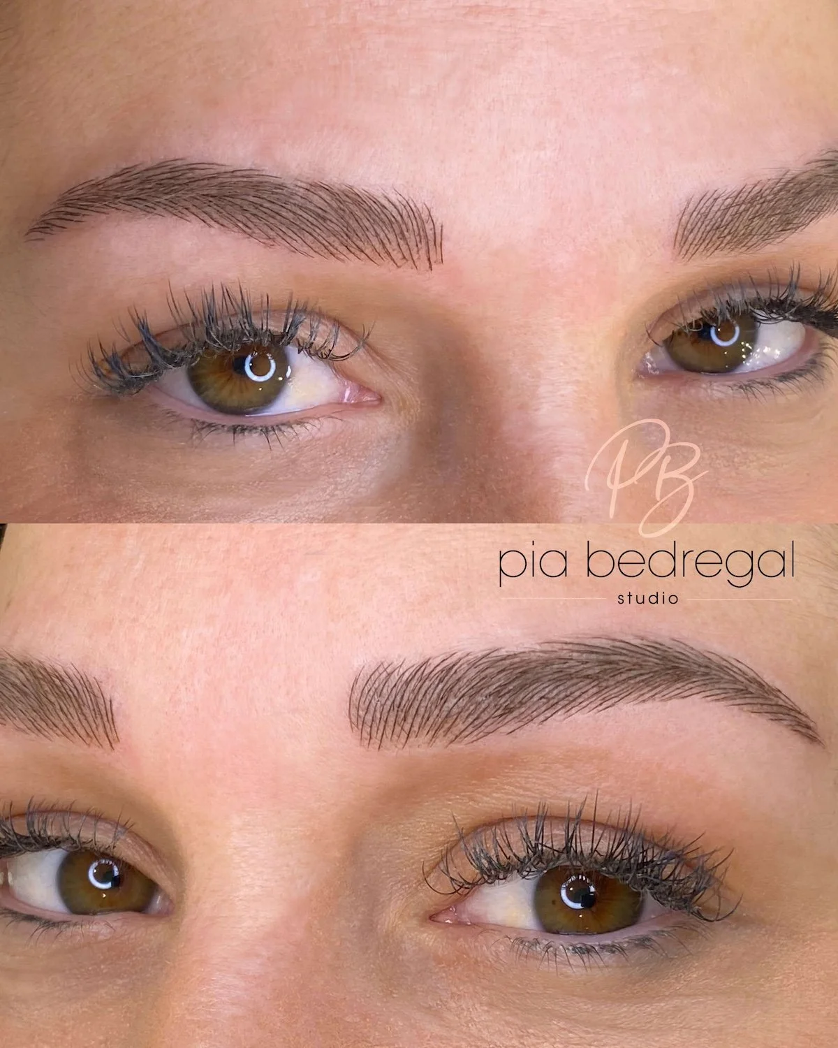 New Eyebrows After Laser Tattoo Removal