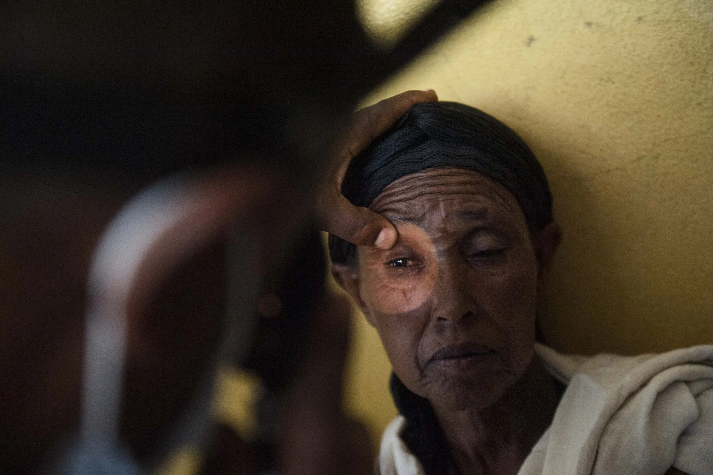 Health workers test for Trachomatous Trichiasis (TT) at the Dire Primary Health Care Unit.